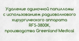Удаление папиллом на радиоволновом аппарате Greenland Medical RFS 3800K